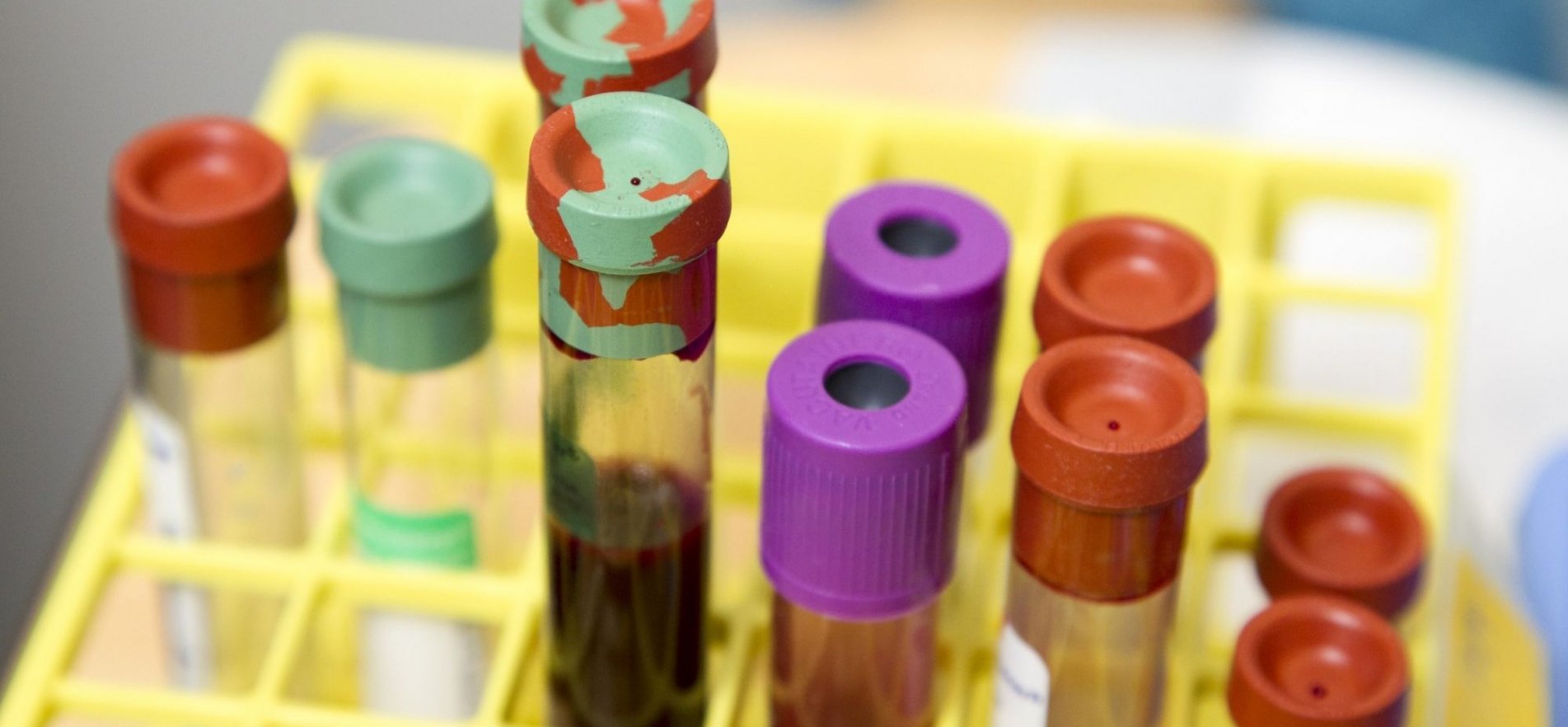 Mobile Phlebotomy Services, Inc Mobile Blood Drawing